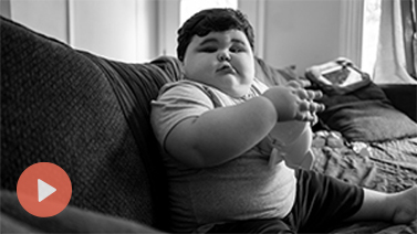 Hear firsthand accounts from people living with symptoms that may be related to a rare genetic disease of obesity