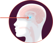 hypothalamus-and-BBS-icon Hypothalamus and BBS